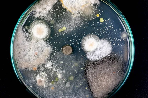 Mold Beautiful, Colony of Characteristics of Fungus (Mold) in culture medium plate from laboratory microbiology.