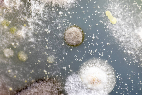 Mold Beautiful, Colony of Characteristics of Fungus (Mold) in culture medium plate from laboratory microbiology.