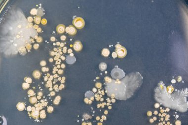 Özellikler ve Farklı şekilli Bakteri ve Küf Kolonisi mikrobiyoloji laboratuarındaki eğitim için toprak örneklerinden tarım plakalarında büyüyor..