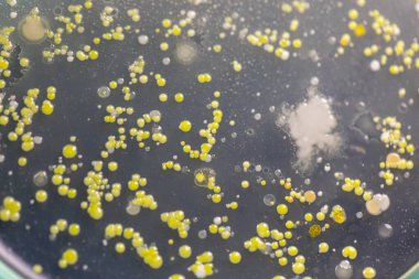 Özellikler ve Farklı şekilli Bakteri ve Küf Kolonisi mikrobiyoloji laboratuarındaki eğitim için toprak örneklerinden tarım plakalarında büyüyor..