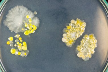 Özellikler ve Farklı şekilli Bakteri ve Küf Kolonisi mikrobiyoloji laboratuarındaki eğitim için toprak örneklerinden tarım plakalarında büyüyor..