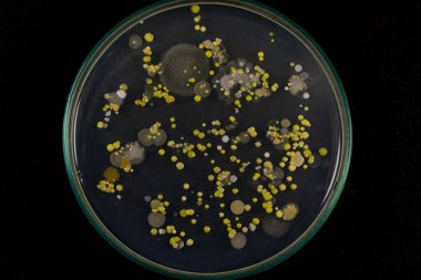 Özellikler ve Farklı şekilli Bakteri ve Küf Kolonisi mikrobiyoloji laboratuarındaki eğitim için toprak örneklerinden tarım plakalarında büyüyor..