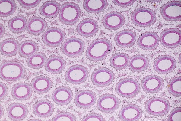 Fában Mint Csoportban Élő Gombák Jellemzői Oktatás Mikroszkópja Alatt Poliferletikusak — Stock Fotó
