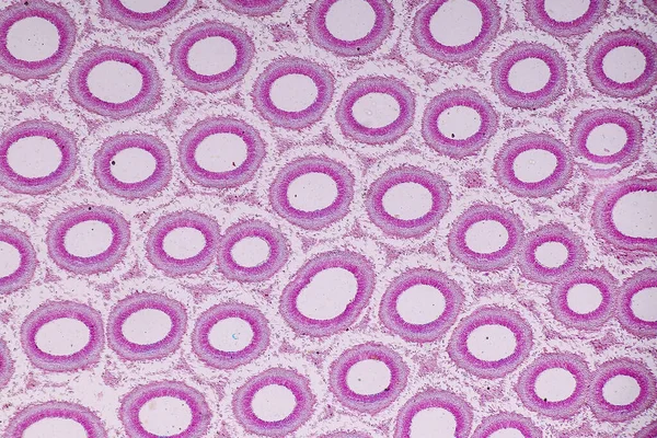 Cechy Charakterystyczne Grzybów Żyjących Drewnie Jako Grupa Polifiletyczne Pod Mikroskopem — Zdjęcie stockowe