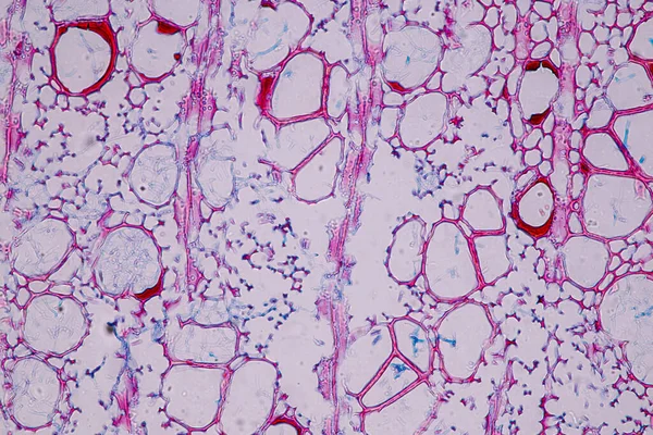 Cechy Charakterystyczne Grzybów Żyjących Drewnie Jako Grupa Polifiletyczne Pod Mikroskopem — Zdjęcie stockowe
