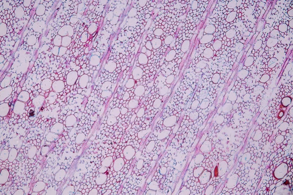 Characteristics Fungi Living Wood Group Polyphyletic Microscope Education — Stock Photo, Image