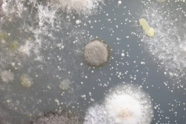 Achtergronden Van Karakteristieken Verschillend Gevormde Kolonie Van Bacteriën Schimmels Die — Stockfoto