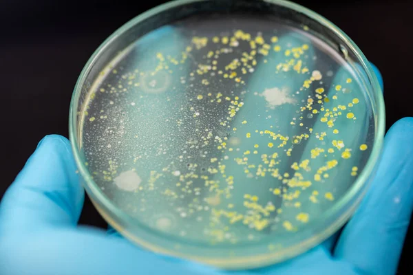 Východiska Charakteristik Různě Tvarovaná Kolonie Bakterií Plísní Rostoucí Agarových Deskách — Stock fotografie