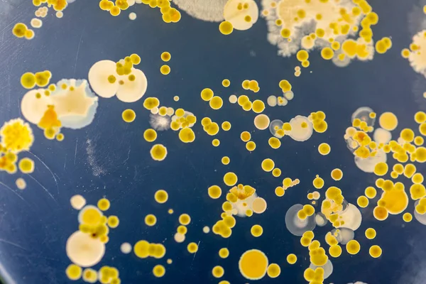 Backgrounds of Characteristics and Different shaped Colony of Bacteria and Mold growing on agar plates from Soil samples for education in Microbiology laboratory.