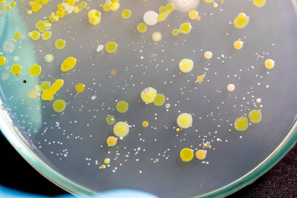 Antecedentes Características Diferentes Formas Colonia Bacterias Moho Que Crece Placas — Foto de Stock