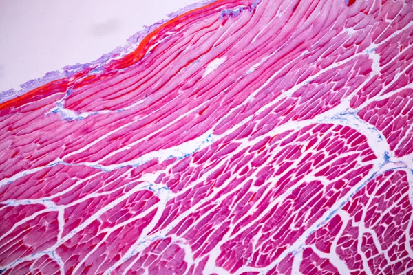 Merkmale Der Anatomie Und Der Histologischen Probe Gestreifter Skelett Muskel Stockfoto