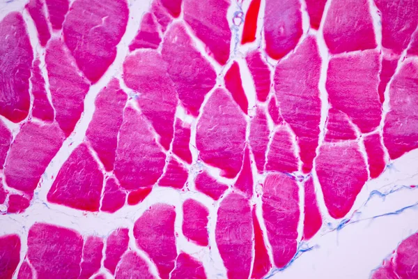 Characteristics Anatomy Histological Sample Striated Skeletal Muscle Mammal Tissue Microscope — Stock Photo, Image