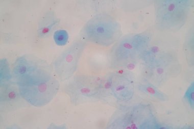 Tarihsel örnek mikroskop altında Squamous epitel hücreleri,