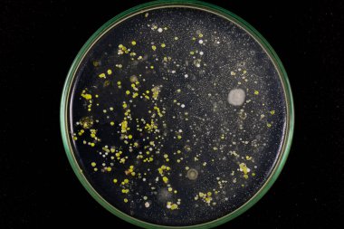 Özellikler ve Farklı şekilli Bakteri ve Küf Kolonisi mikrobiyoloji laboratuarındaki eğitim için toprak örneklerinden tarım plakalarında büyüyor..