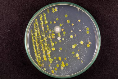 Özellikler ve Farklı şekilli Bakteri ve Küf Kolonisi mikrobiyoloji laboratuarındaki eğitim için toprak örneklerinden tarım plakalarında büyüyor..