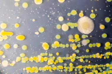 Özellikler ve Farklı şekilli Bakteri ve Küf Kolonisi mikrobiyoloji laboratuarındaki eğitim için toprak örneklerinden tarım plakalarında büyüyor..