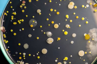 Özellikler ve Farklı şekilli Bakteri ve Küf Kolonisi mikrobiyoloji laboratuarındaki eğitim için toprak örneklerinden tarım plakalarında büyüyor..