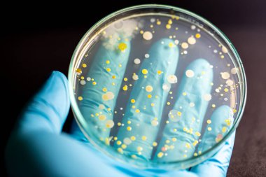 Özellikler ve Farklı şekilli Bakteri ve Küf Kolonisi mikrobiyoloji laboratuarındaki eğitim için toprak örneklerinden tarım plakalarında büyüyor..