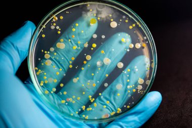 Özellikler ve Farklı şekilli Bakteri ve Küf Kolonisi mikrobiyoloji laboratuarındaki eğitim için toprak örneklerinden tarım plakalarında büyüyor..