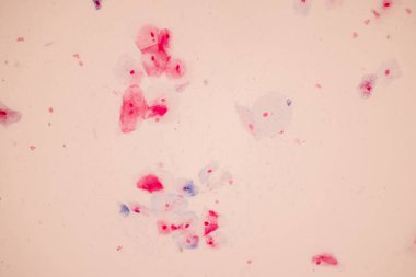 Tarihsel örnek mikroskop altında Squamous epitel hücreleri,