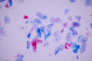 Tarihsel örnek mikroskop altında Squamous epitel hücreleri,