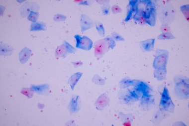 Tarihsel örnek mikroskop altında Squamous epitel hücreleri,