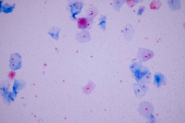 Tarihsel örnek mikroskop altında Squamous epitel hücreleri,