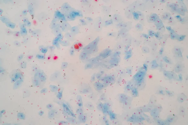 Histologisch Monster Plaveiselcelepitheelcellen Onder Microscoop — Stockfoto