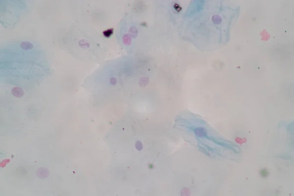 Amostra Histológica Células Epiteliais Escamosas Microscópio — Fotografia de Stock