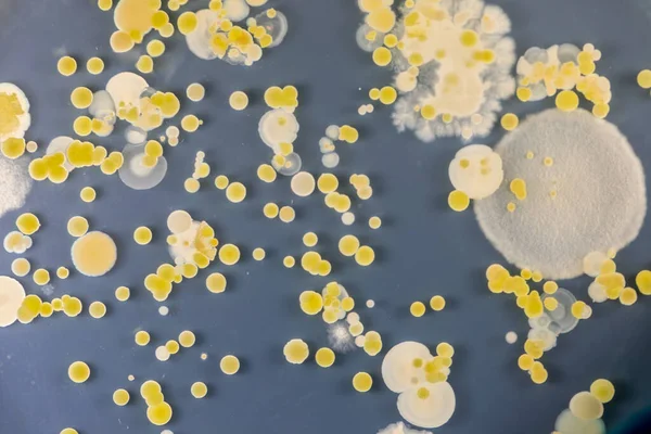 Antecedentes Características Diferentes Formas Colonia Bacterias Moho Que Crece Placas —  Fotos de Stock