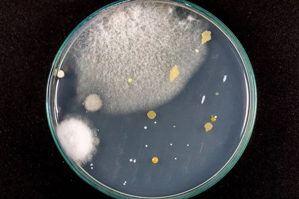 Özellikler ve Farklı şekilli Bakteri ve Küf Kolonisi mikrobiyoloji laboratuarındaki eğitim için toprak örneklerinden tarım plakalarında büyüyor..