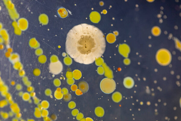 Backgrounds of Characteristics and Different shaped Colony of Bacteria and Mold growing on agar plates from Soil samples for education in Microbiology laboratory.