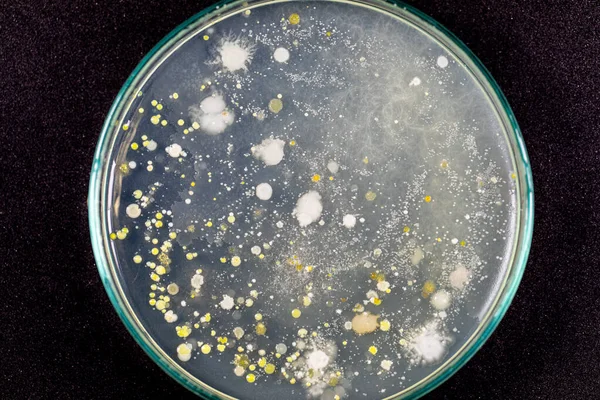 Antecedentes Características Diferentes Formas Colonia Bacterias Moho Que Crece Placas — Foto de Stock