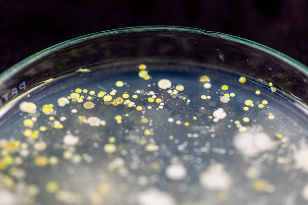 Backgrounds of Characteristics and Different shaped Colony of Bacteria and Mold growing on agar plates from Soil samples for education in Microbiology laboratory.