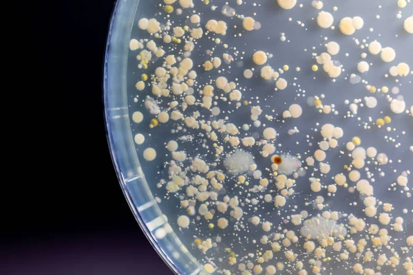 Özellikler Farklı Şekilli Bakteri Küf Kolonisi Mikrobiyoloji Laboratuarındaki Eğitim Için — Stok fotoğraf