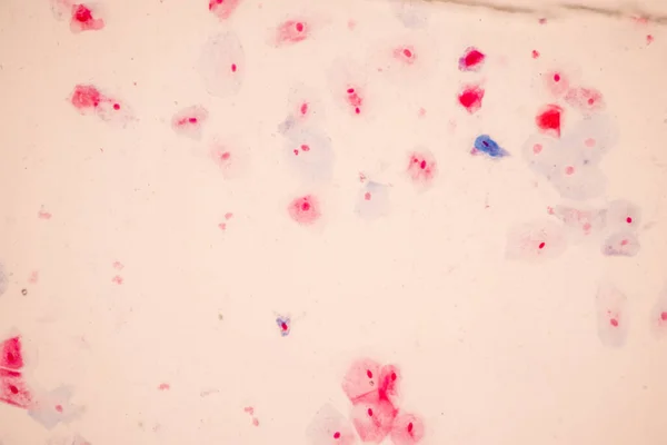 Histologisch Monster Plaveiselcelepitheelcellen Onder Microscoop — Stockfoto