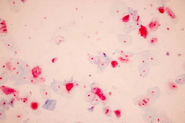 Histologisch Monster Plaveiselcelepitheelcellen Onder Microscoop — Stockfoto