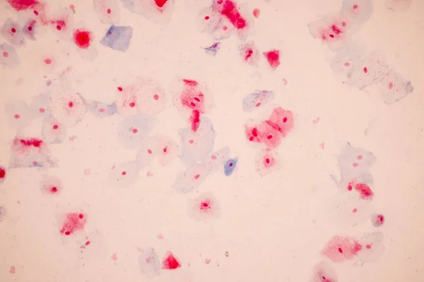 Histologisch Monster Plaveiselcelepitheelcellen Onder Microscoop — Stockfoto