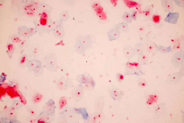 Próbka Histologiczna Komórki Nabłonka Płaskiego Pod Mikroskopem — Zdjęcie stockowe