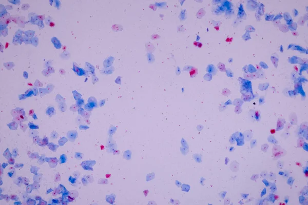 Histologisch Monster Plaveiselcelepitheelcellen Onder Microscoop — Stockfoto