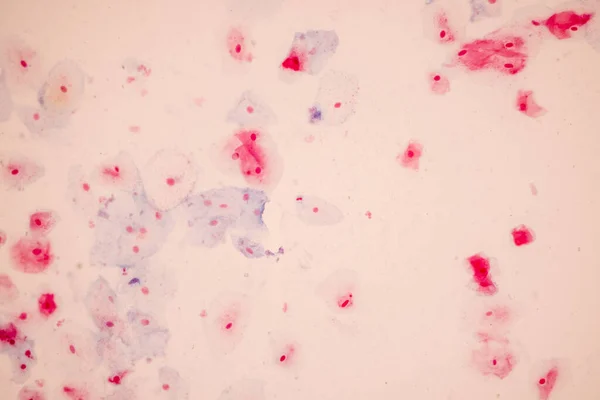 Campione Istologico Cellule Epiteliali Squamose Microscopio — Foto Stock