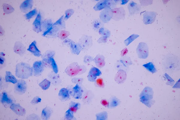 Ιστολογικό Δείγμα Squamous Επιθηλιακά Κύτταρα Κάτω Από Μικροσκόπιο — Φωτογραφία Αρχείου