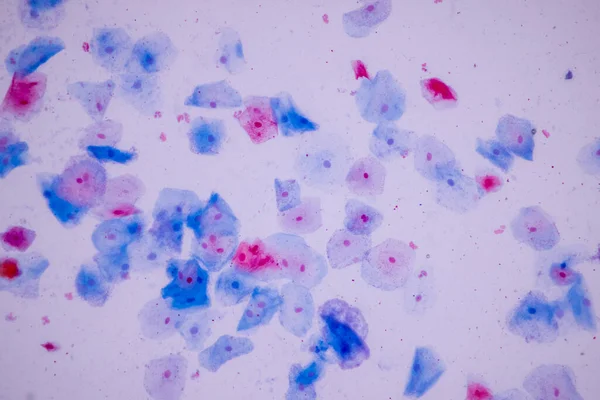 Amostra Histológica Células Epiteliais Escamosas Microscópio — Fotografia de Stock