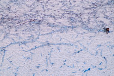 Sporlu ev sahibi hücreler (küf) eğitim için mikroskop altında odunların içindedir..