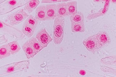 Mitosis cell in the Root tip of Onion under a microscope.