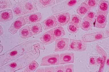 Mitosis cell in the Root tip of Onion under a microscope.