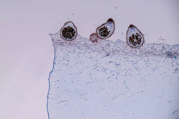 곰팡이 주둥이 세포는 교육을 현미경 — 스톡 사진