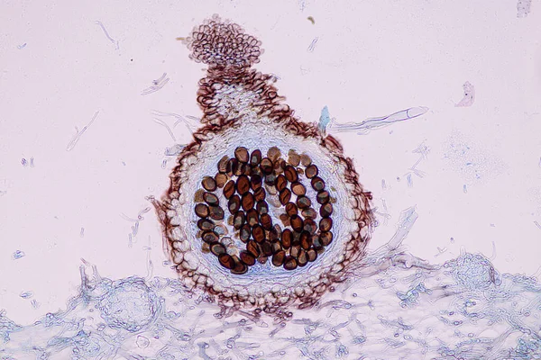 带有孢子 的宿主细胞在显微镜下接受教育 — 图库照片