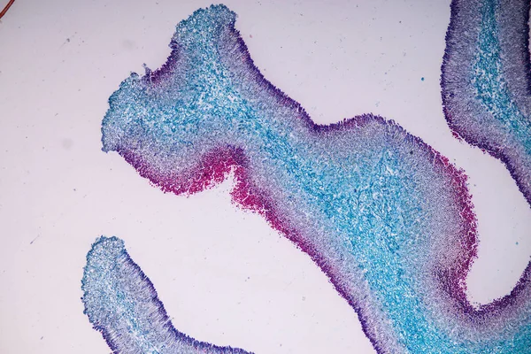 Hostitelské Buňky Spory Plísní Jsou Uvnitř Dřeva Pod Mikroskopem Pro — Stock fotografie