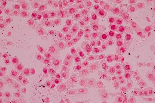 Mitóza Buňky Kořenové Špičce Cibule Pod Mikroskopem — Stock fotografie